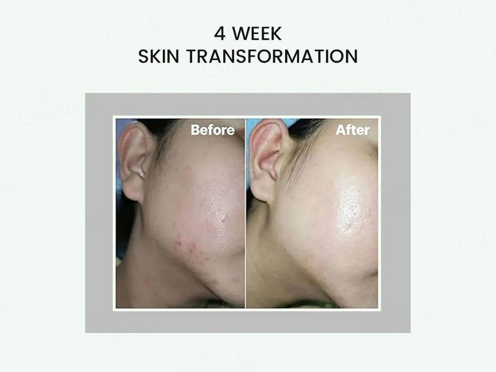 CelimaxTheRealNoniEnergyAmpoule50ml7