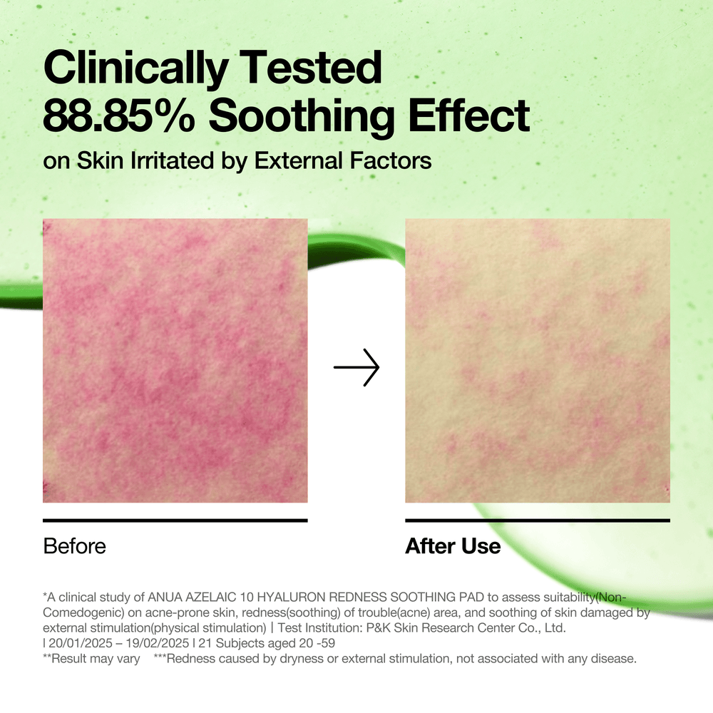 anua-us-toner-90-ea-azelaic-10-hyaluron-redness-soothing-pad-1170826121