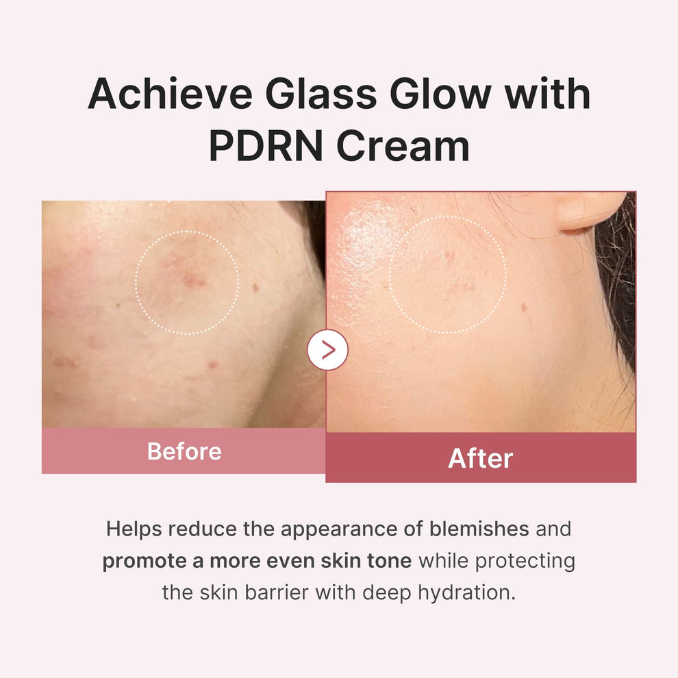 pdrn-pink-hyaluronic-moisturizing-cream-1212886245
