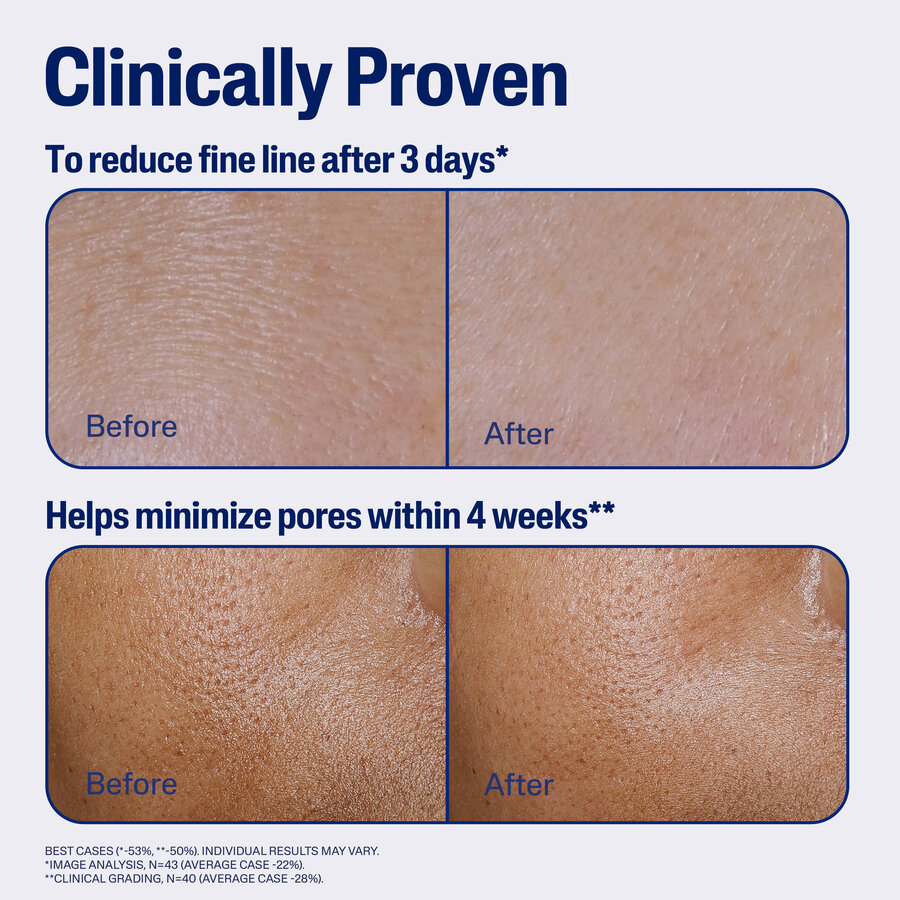 Advanced-Defenced-Serum_ATF5_BeforeAfter_
