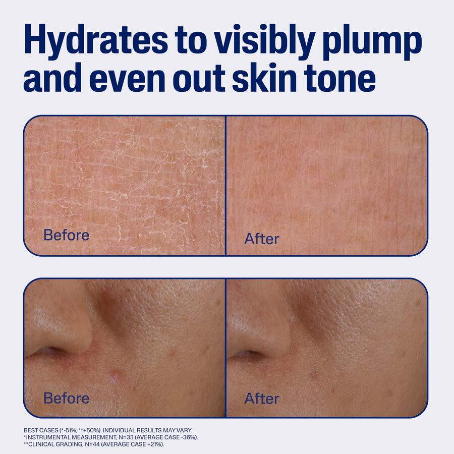 Repair&RenewSerum_ATF5_BeforeAfter_