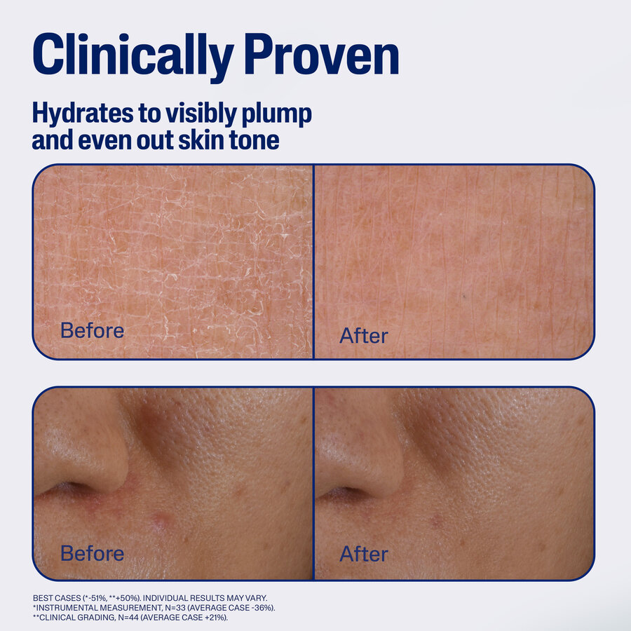 Repair&RenewSerum_ATF5_BeforeAfter_2