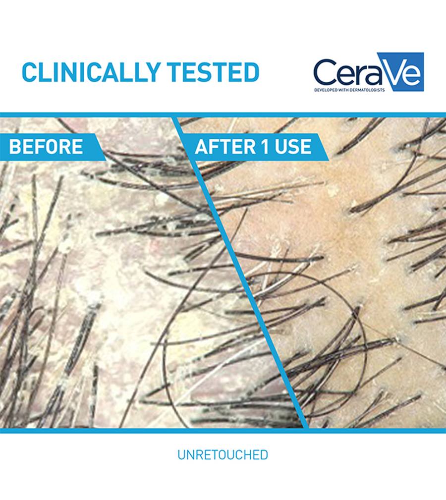 CeraVe-AntiDandruffHydratingShampoo-12oz-US-Clinicals_1_700x785_v1
